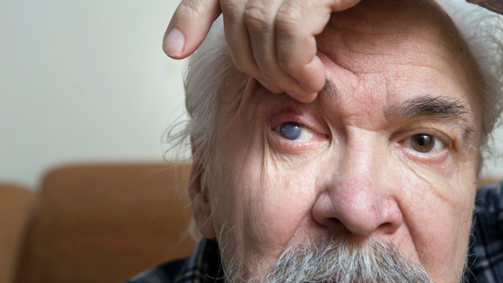 Você sabe o que é Glaucoma?